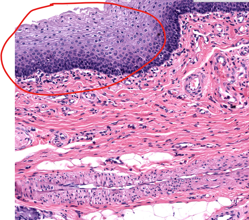 <p>tissue type</p>