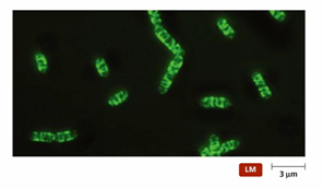<p>Bepaalt vorm van de bacterie</p><p>Cytoskelet → bacillus</p><p>Geen cytoskelet → coccus</p>