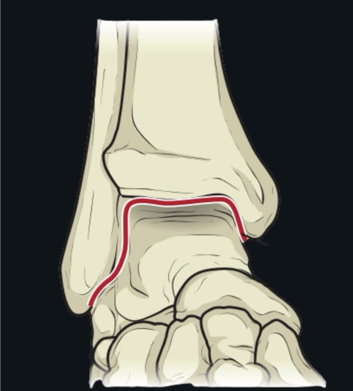 <p>What is this joint? </p>
