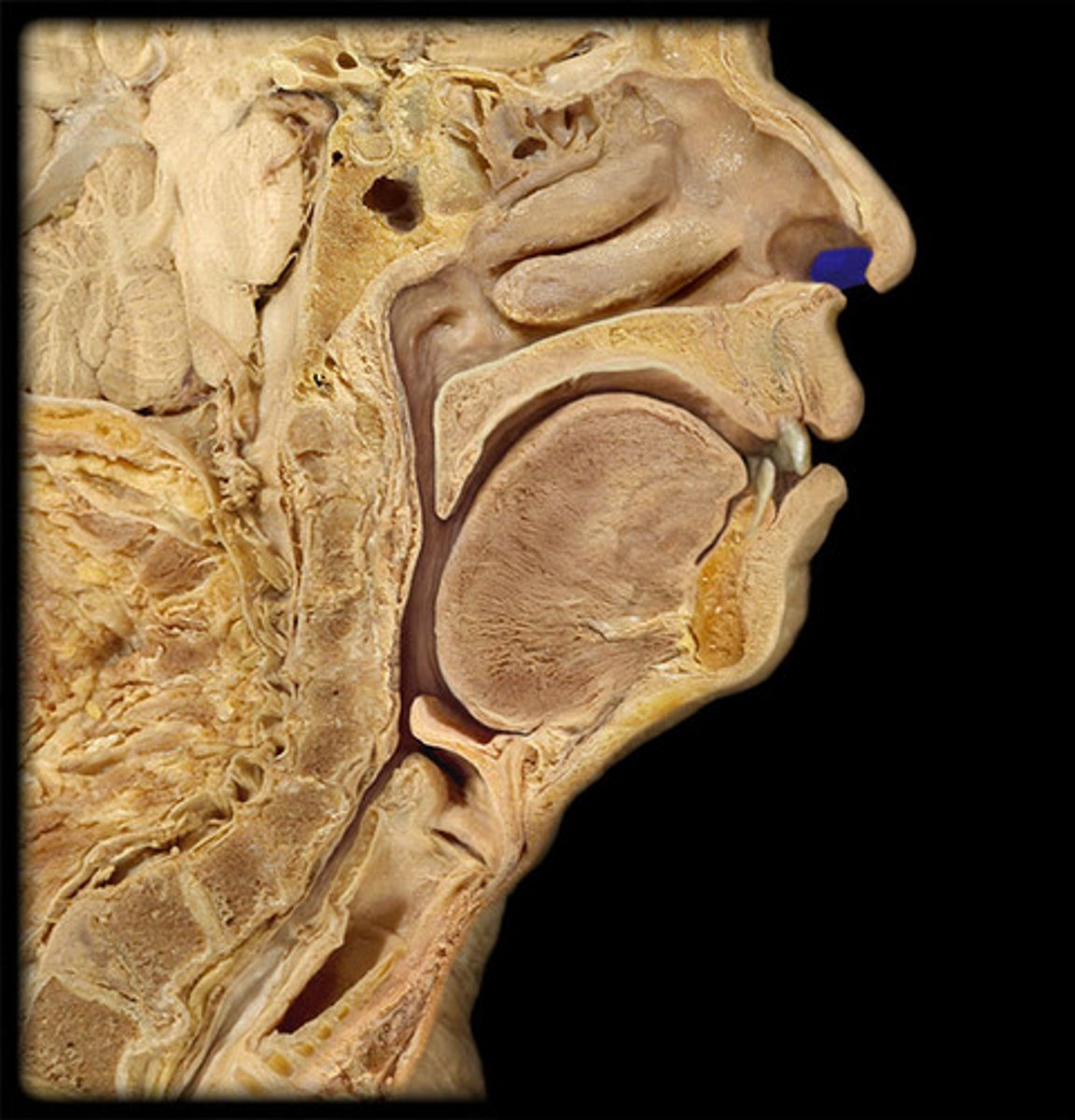 <p>dilated portion of nose inside each aperture, lined with skin</p>