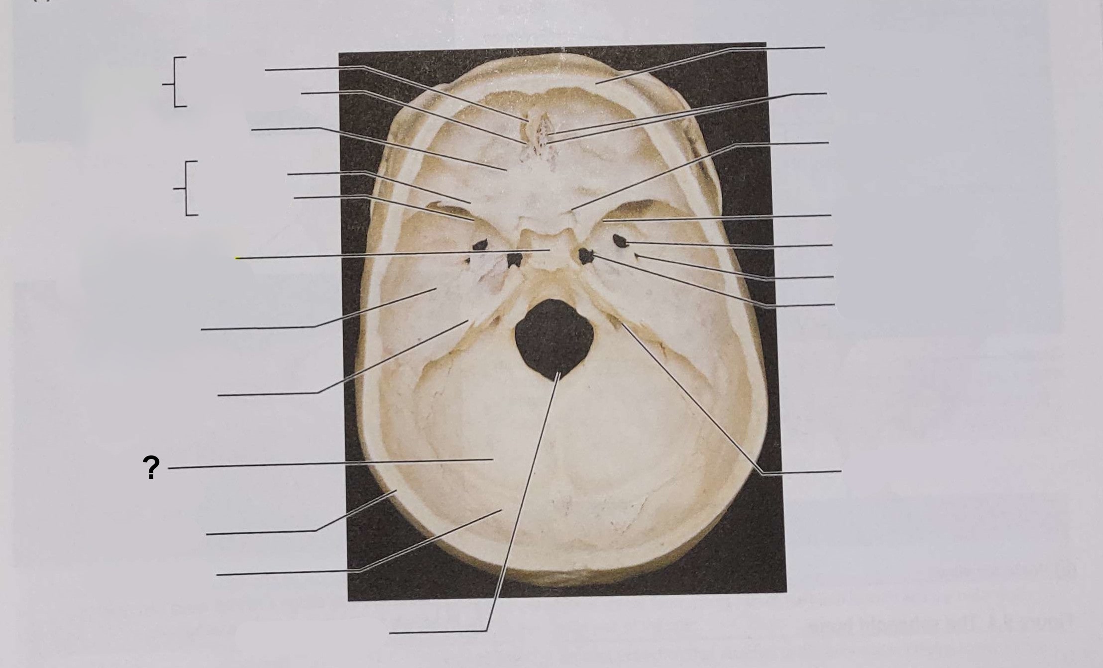 <p>Name the indicated structure</p>