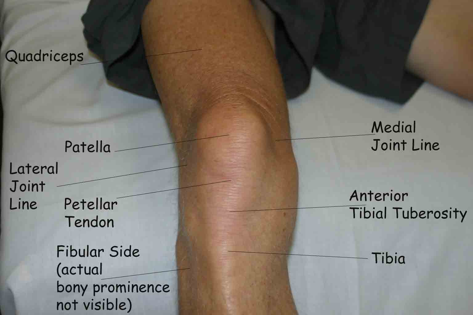 <p><span>Go back to the femoral condyles, and with 90 degrees knee flexion (foot flat on plinth), palpate the space between the femoral condyles and tibial condyles on either side. You may start centrally either side of the patellar tendon and move in either direction. Tenderness on the joint line may indicate meniscal injury. Medially and laterally rotate the knee.</span></p>