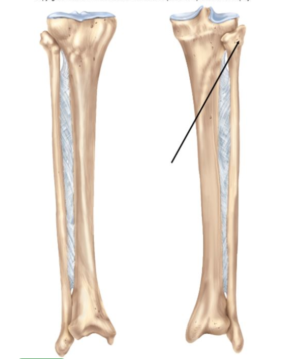 The process indicated in the figure is the