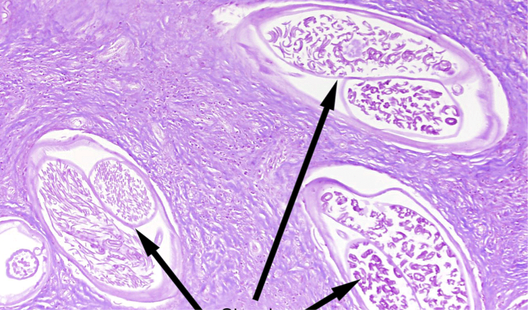 term image