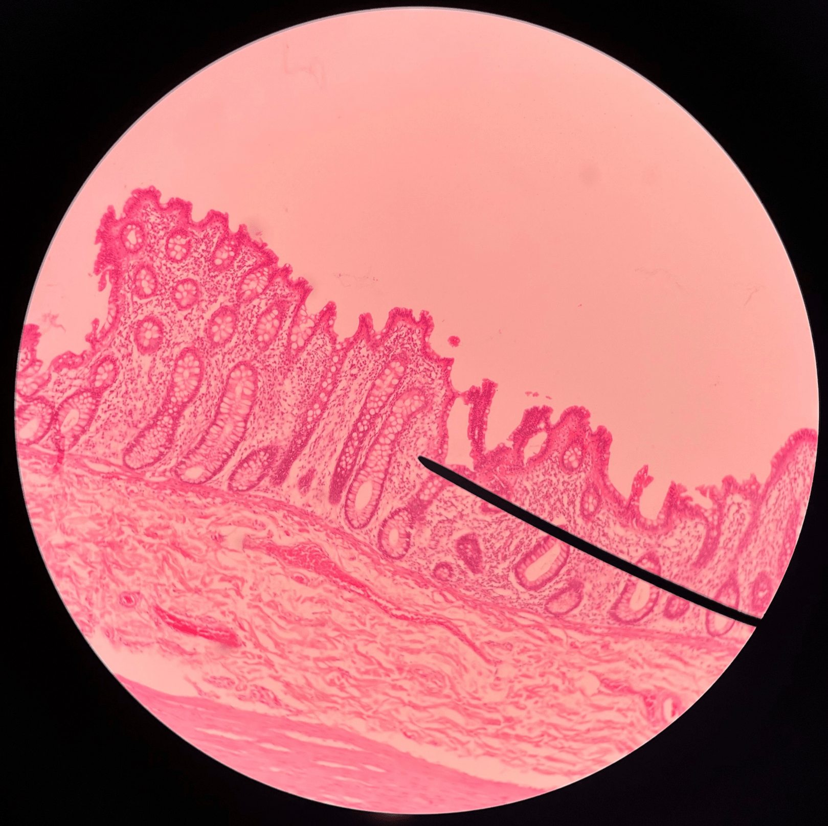• Slide histology of the large intestine.

• The deepest layer of the large intestine.

• Deep to the submucosa.