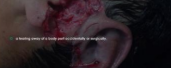 <p>what kind of wound is this</p>