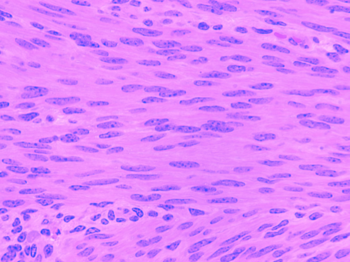 <p>Identify this tissue type</p>
