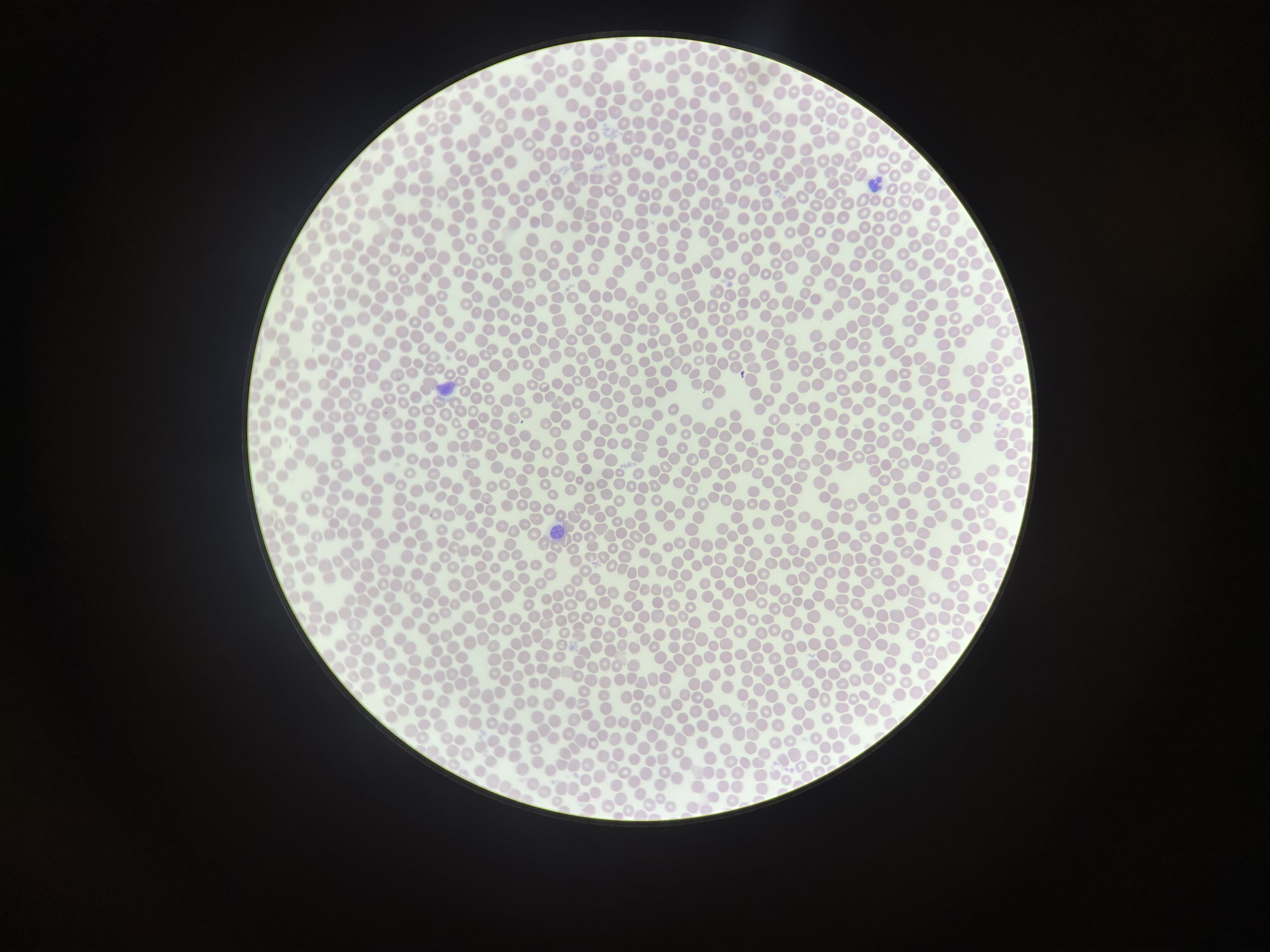 <p>What is the magnification level of the Blood?</p>