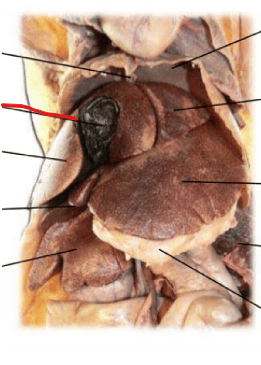 <p>A muscular sac attached to the liver</p>