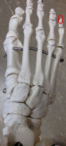 Identify this bone.

