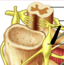 <p>big yellow thing</p>