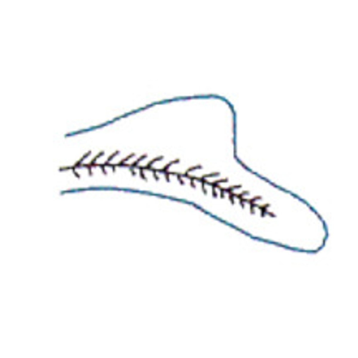 <p>lower/ventral lobe longer than upper/dorsal; vertebral column extending into ventral lobe</p>