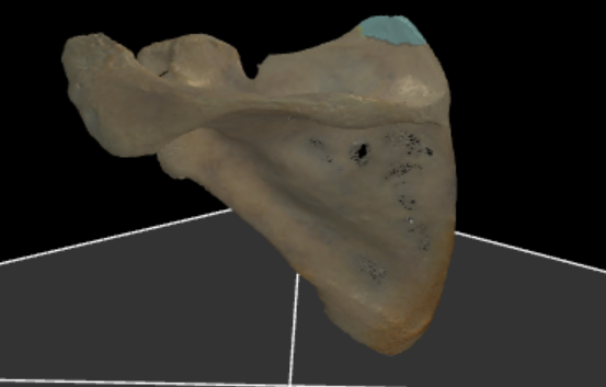 <p>de bovenste hoek van de scapula</p>