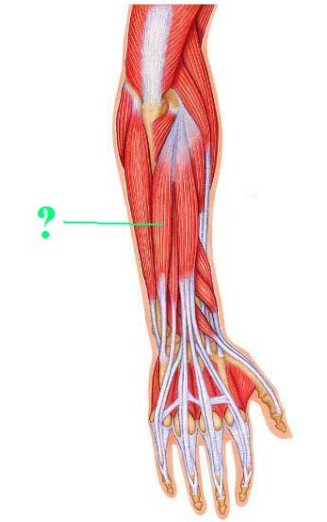 <p><span>Identify the indicated muscle.</span></p>