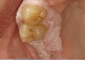 <p>what is the diagnosis </p>