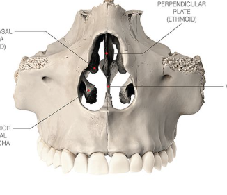 <p>what is this, its description and its appearance on images</p>