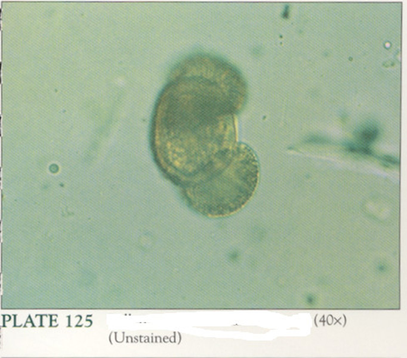<p>Seasonal contaminants that appear as spheres with cell walls and occasional concentric circles.</p>