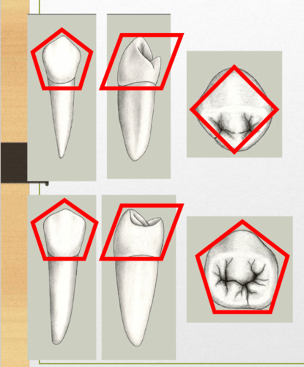 <p>Pentagonal</p><p>Rhomboidal</p><p>1st-Rhomboidal or Diamond</p><p>2nd- Pentagonal</p>