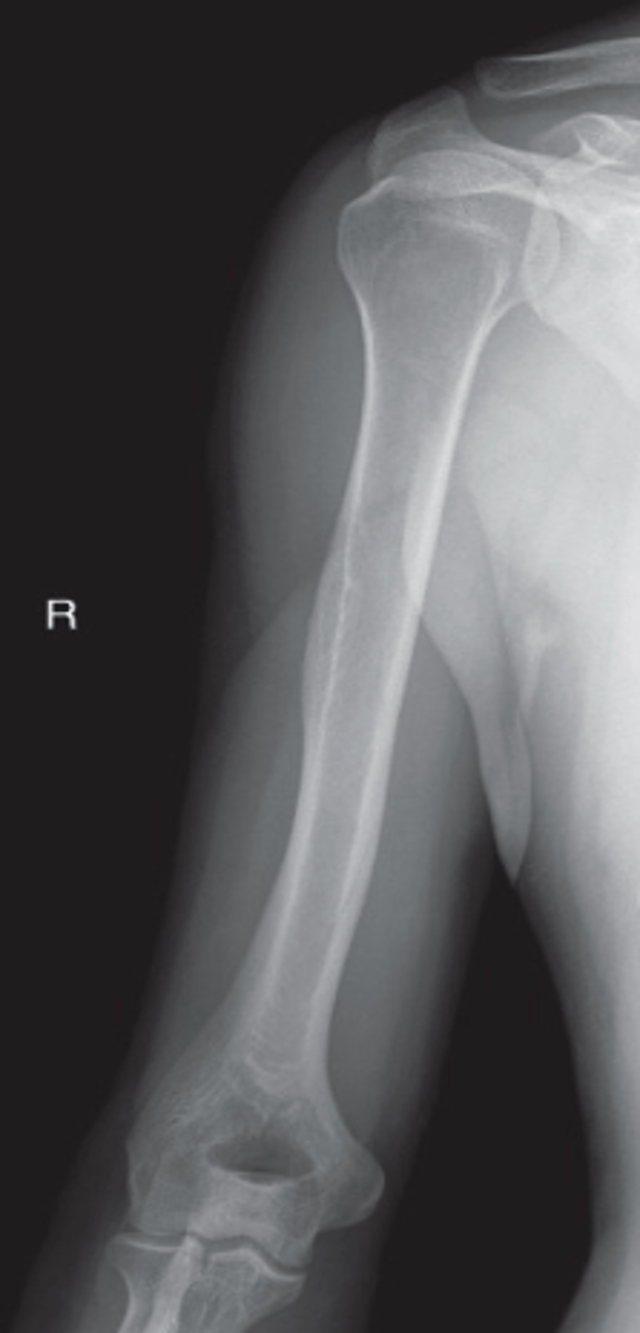 <p>1. What projection is shown in the image?</p><p>2. What are the clinical indications for this projection?</p><p>3. Is this an optimal image?</p><p>4. Name all of the anatomy.</p><p>5. Does this image meet all criteria?</p><p>6. Where is the CR placed?</p><p>7. If applicable, what method is interchangeable with this projection?</p>