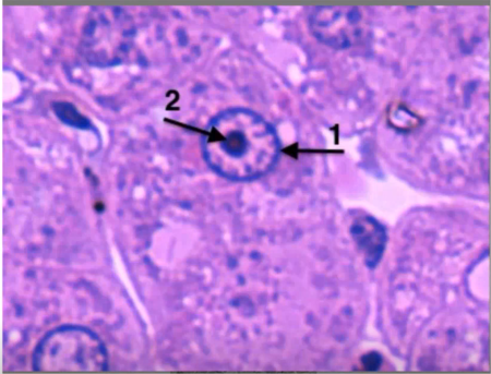 <p>Identify the following structures in electron micrograph #2</p>