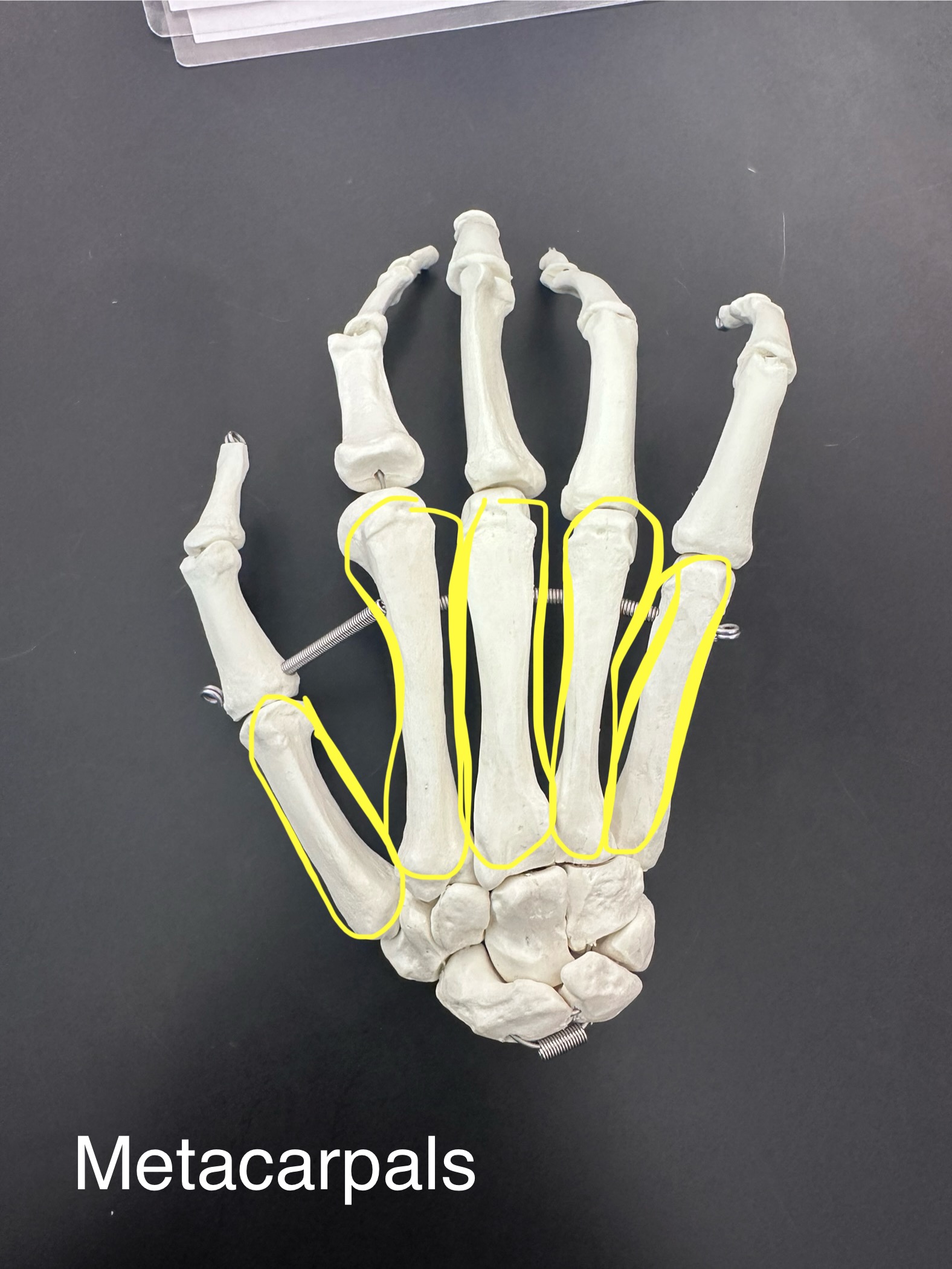 <p>Metacarpals</p>