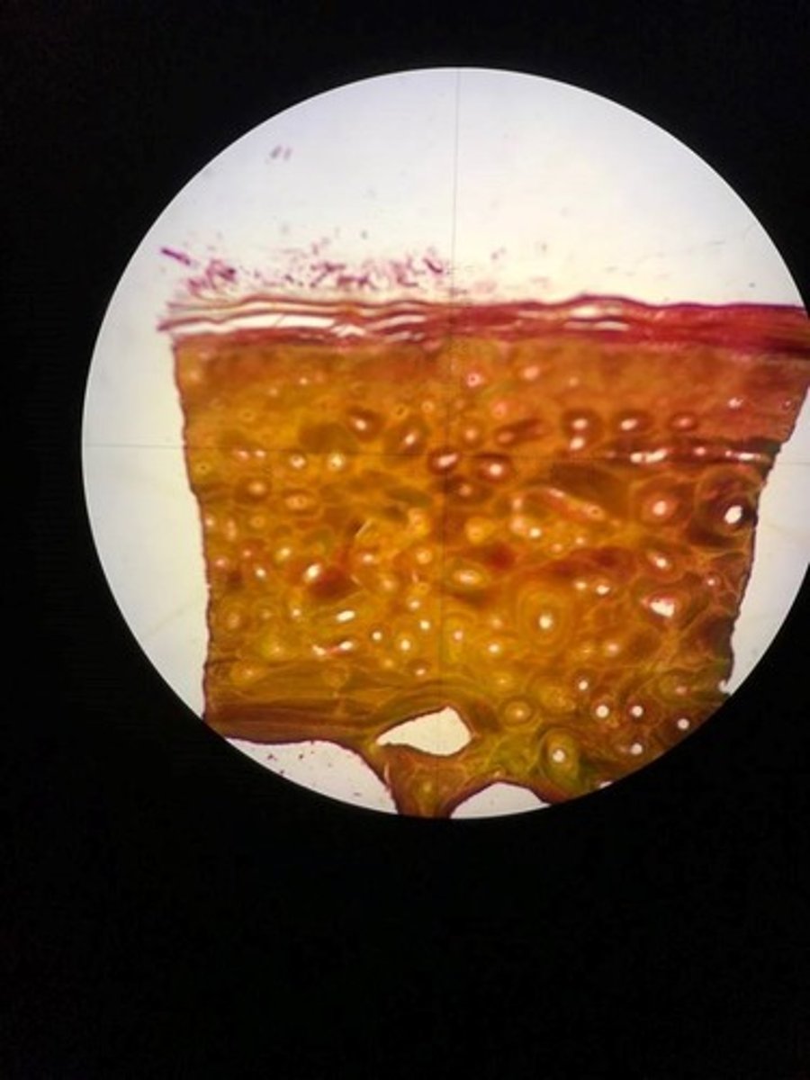 <p>Iš vidaus kaulą iškloja vidinis antkaulis, plonas puraus jungiamojo audinio sluoksnis.</p>