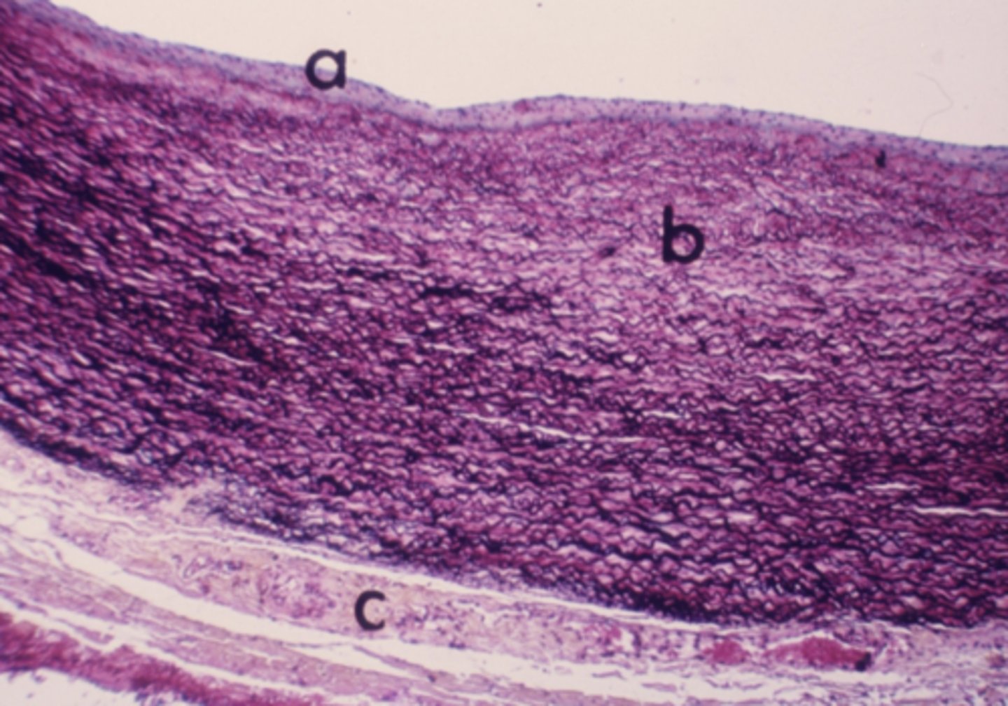 <p>What type of connective tissue is located in the area labeled "b"?</p>