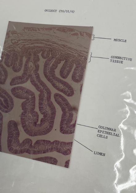 <p>oviduct - columnar </p>