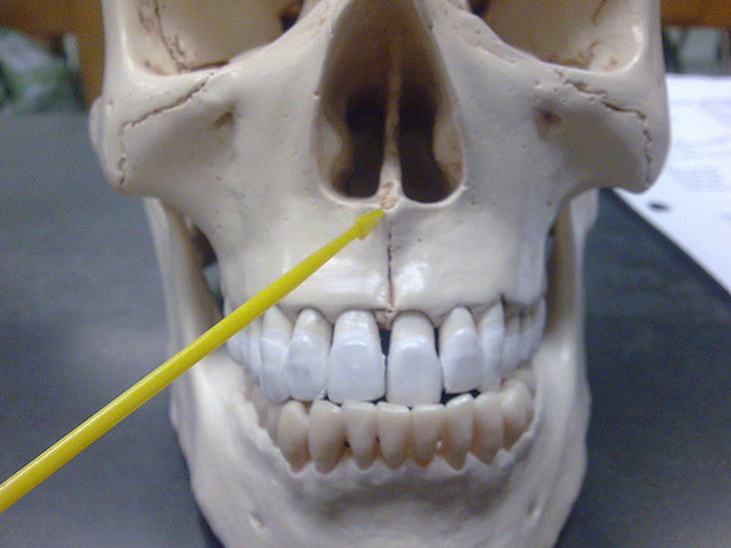 <p>What is the upper portion of the midline union between the two maxillae?</p>