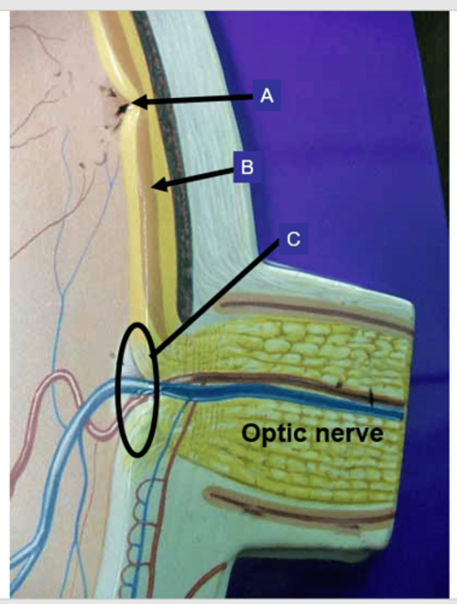 <p>What structure is the letter A?</p>