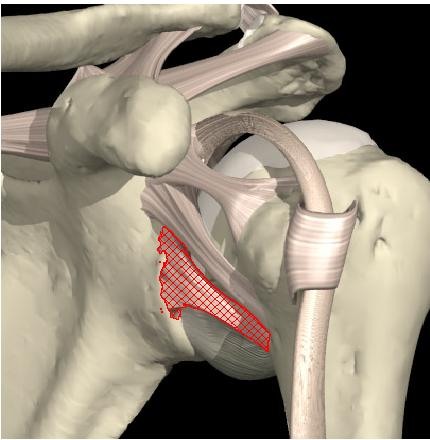 <p>extends from the glenoid labrum to inferomedial part of the humeral neck</p><p>it is the strongest of the GH ligaments, it stabilizes the humeral head when the arm is abducted above 90 degrees</p>