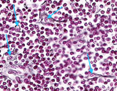 These cells produce reticular fiber stroma that supports other cells in lymphoid organs