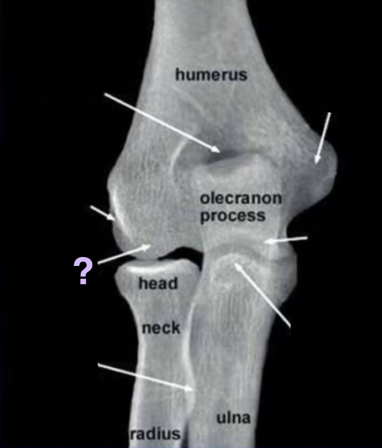 term image