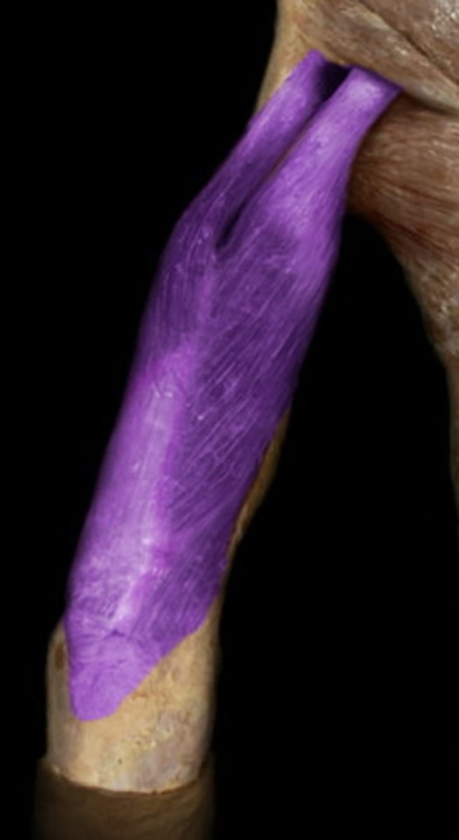 <p>triceps brachii</p>