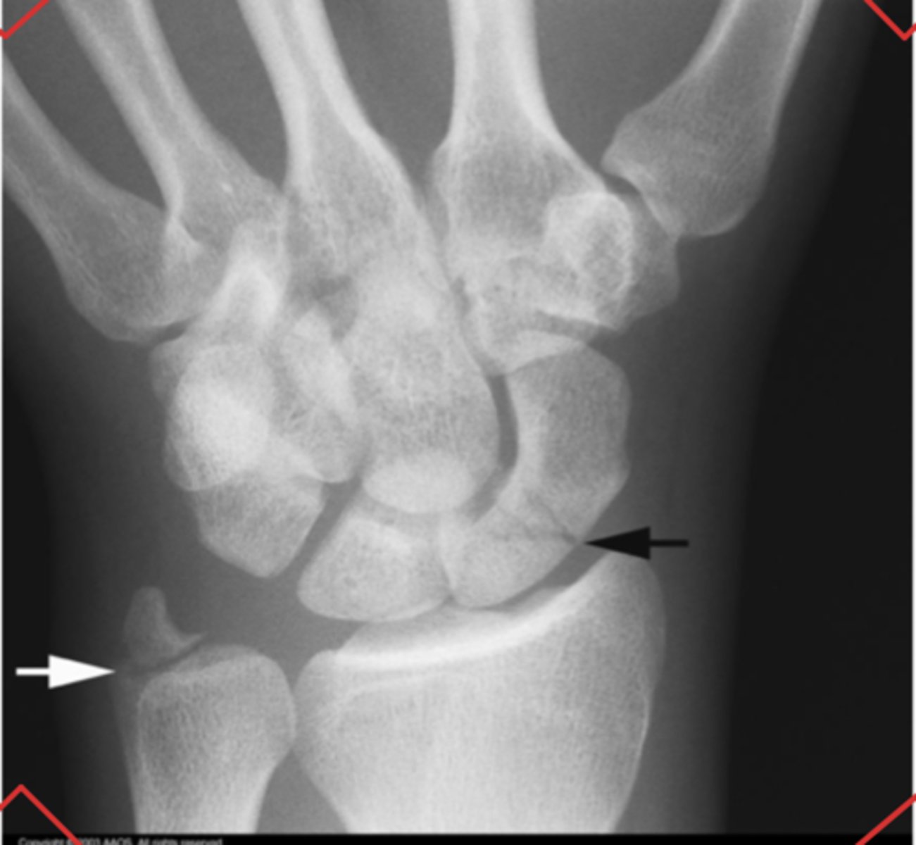 <p>What is the issue?</p>