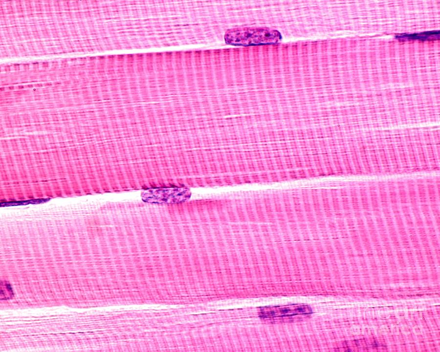 <p>myofilaments arranged in alternating light and dark regions; appear striped or striated under microscope</p>