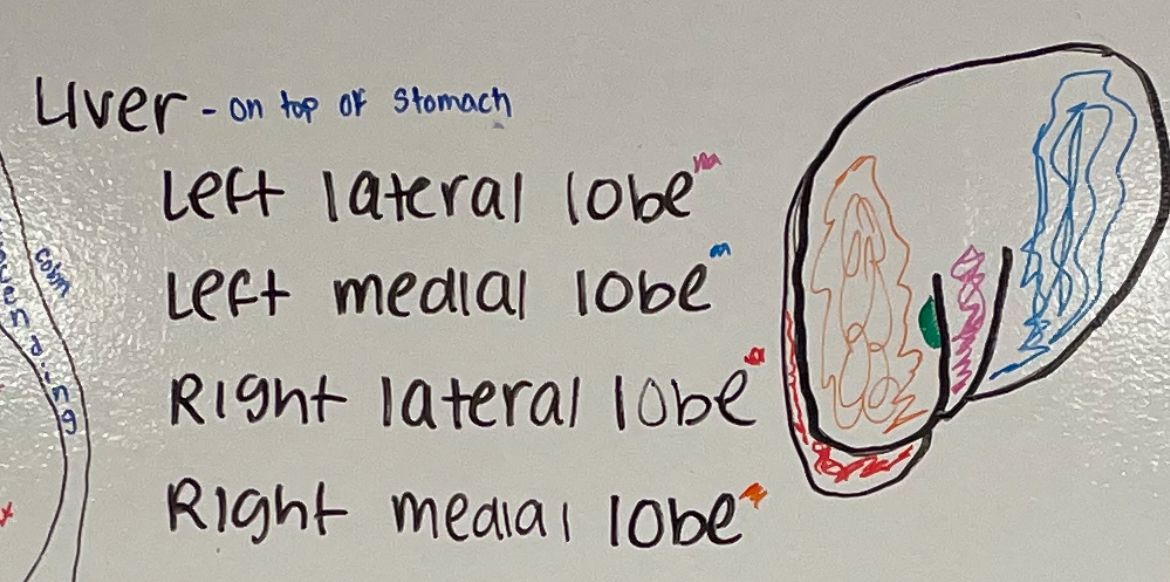 <p>right lateral lobe</p>