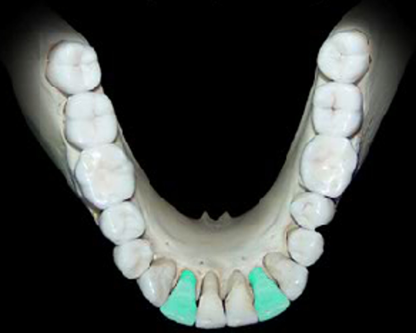 <p>specific area of teeth</p>