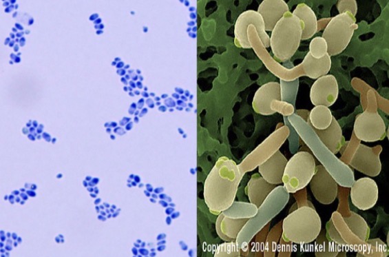 <p>Genus: Candida</p>