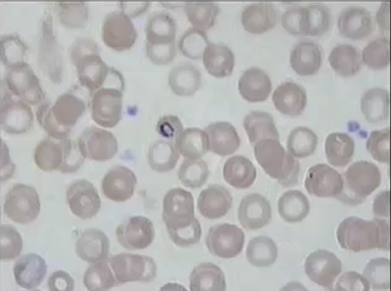 <p>What is the organism within the central red blood cell? What phylum does it belong to?</p>