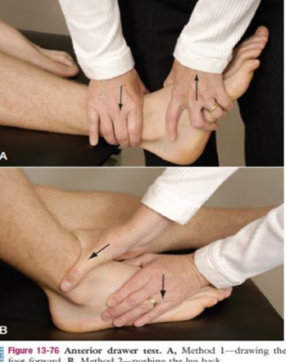 <p>- anterior talofibular ligament</p><p>(+): talus has excessive anterior glide / pain is noted</p>