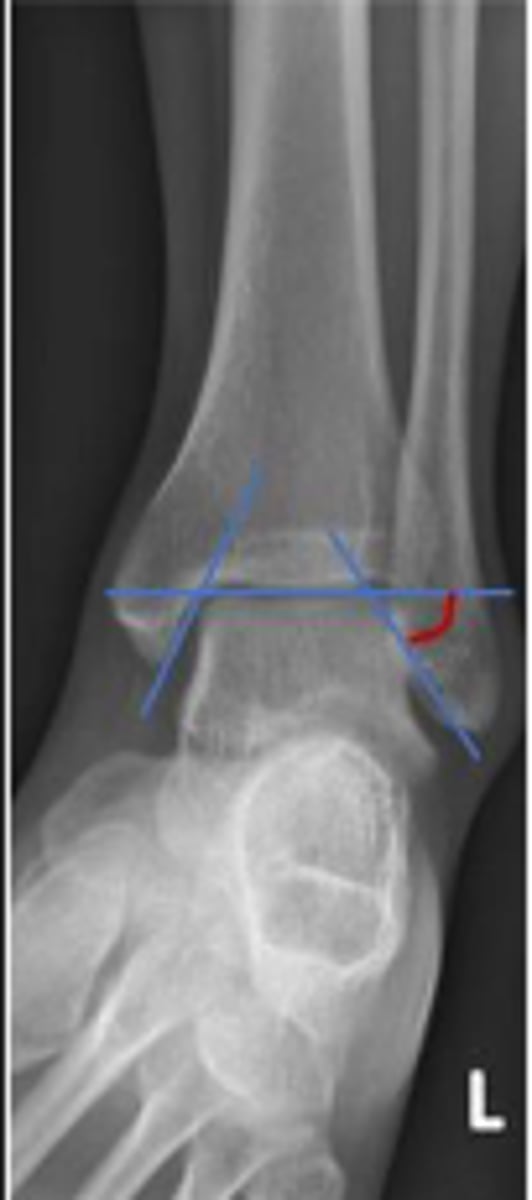 <p>What is the name of the assessment?</p>