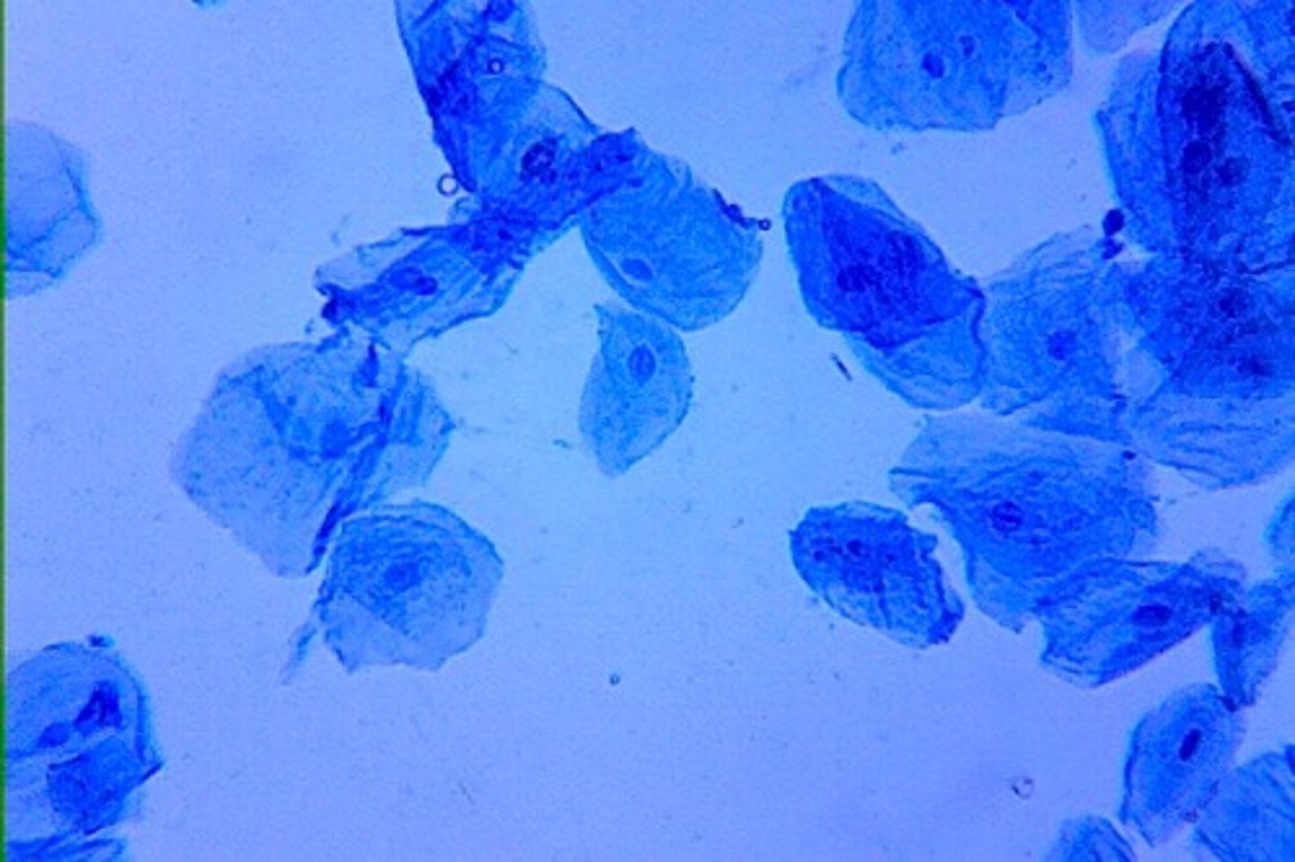 <p>blue dye to stain cheek cells to make them easily observable</p>