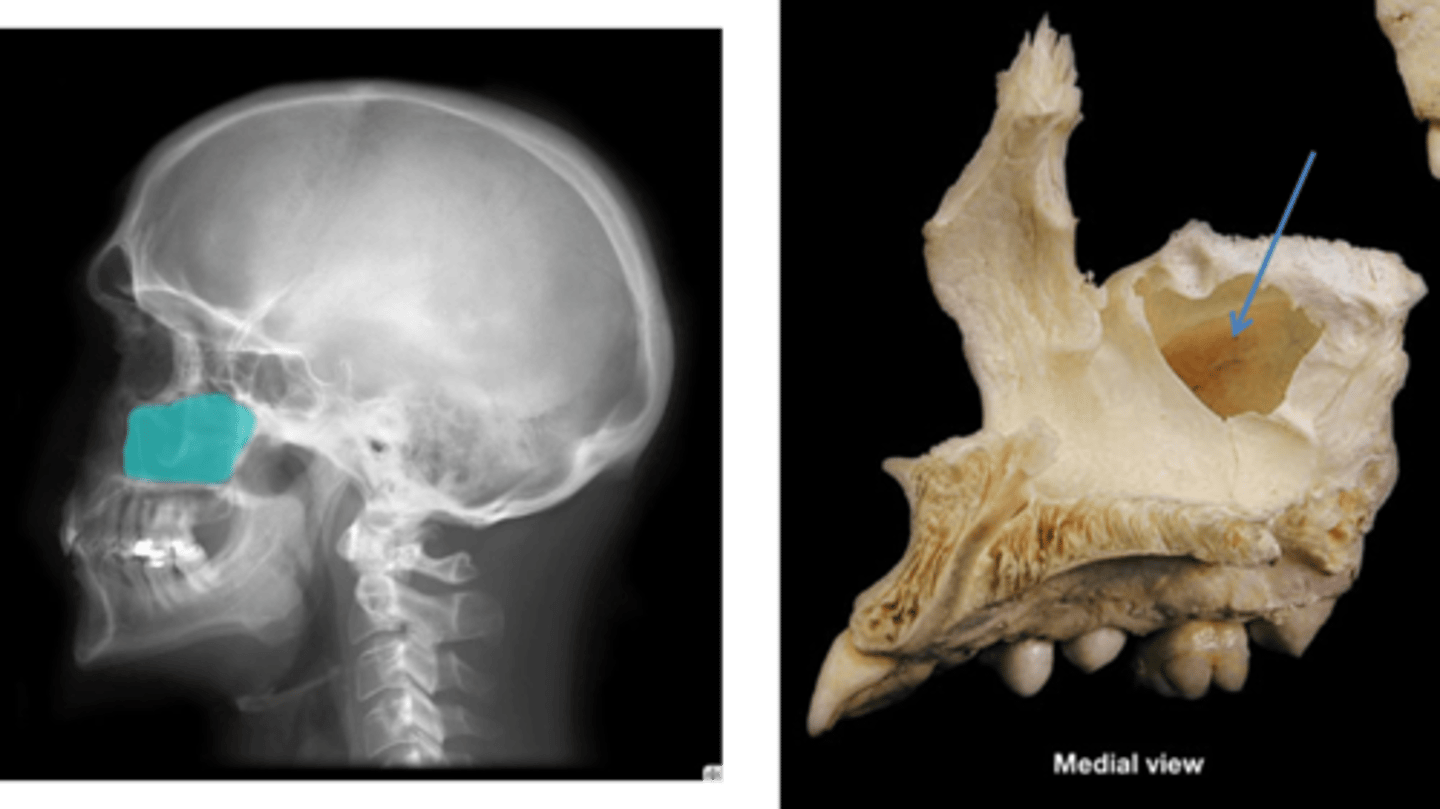 <p>Name this space.</p>