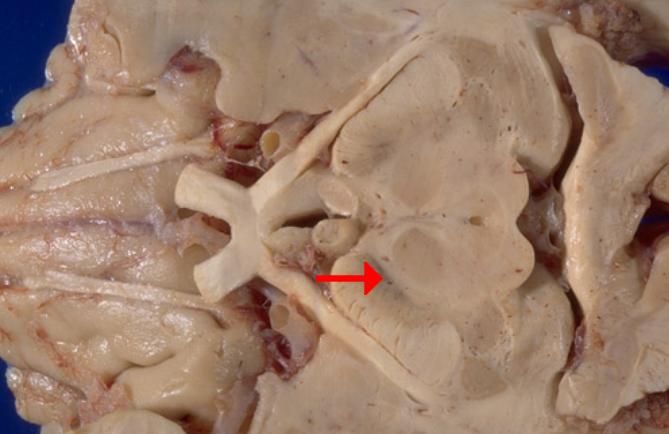 <p>Label this brain structure</p>