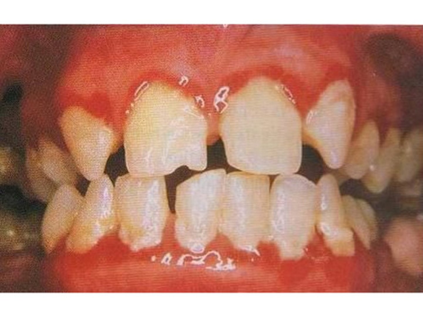 <p>a substance primarily composed of bacteria and saliva that forms on teeth</p>