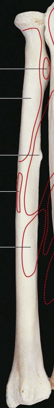 <p>stipinkaulis</p>