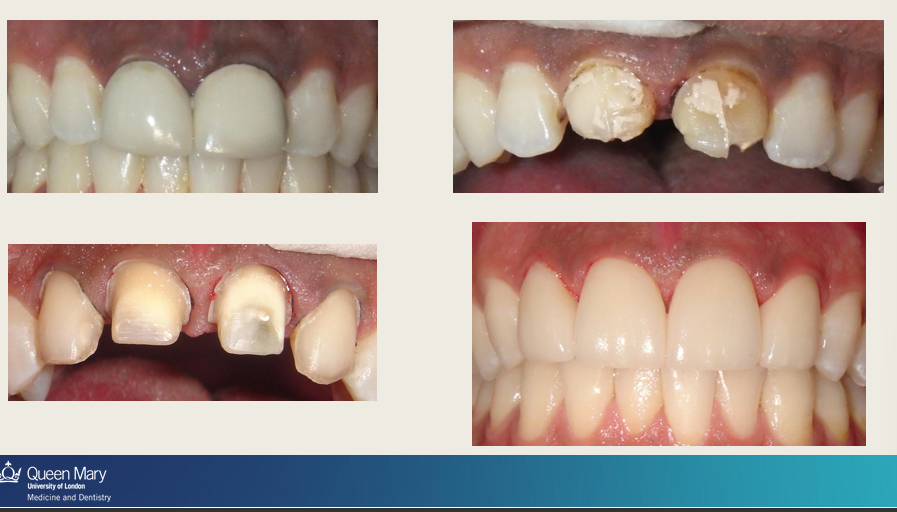 <p>What is the problem?</p>