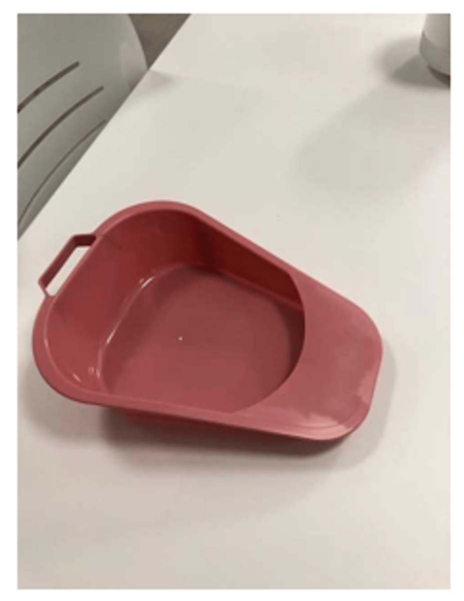 <p>What does image show?</p>