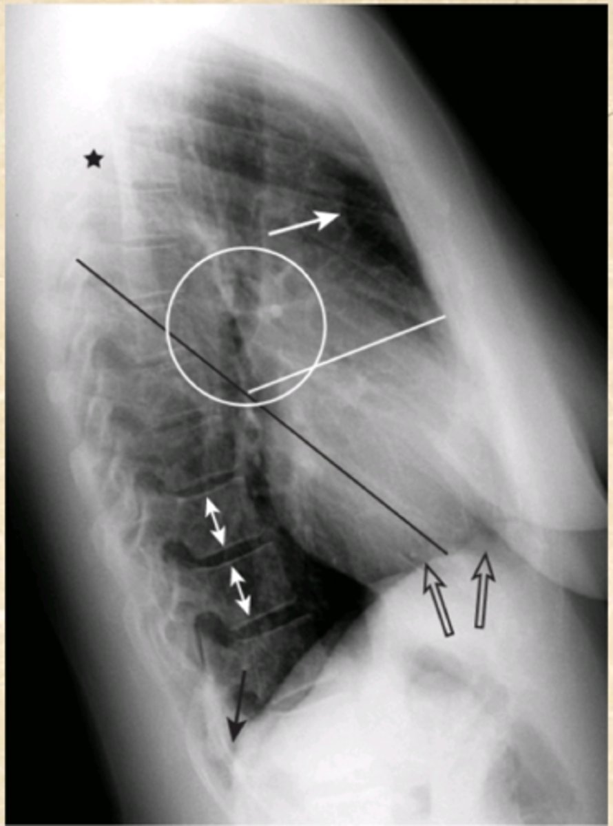 <p>Diagnosis?</p><p>View?</p>